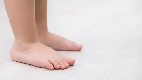 باله و ژیمناستیک در بهبود کف پای صاف